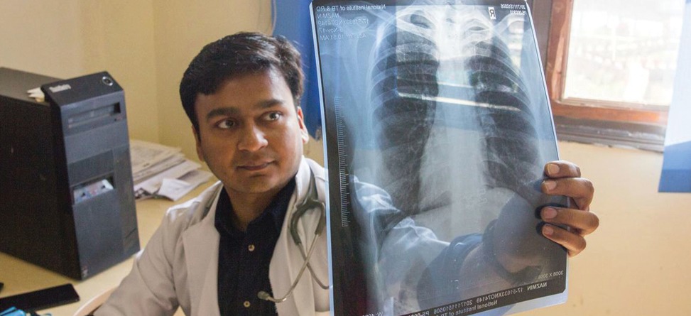 Feu vert de l’OMS à un premier test de diagnostic de la tuberculose