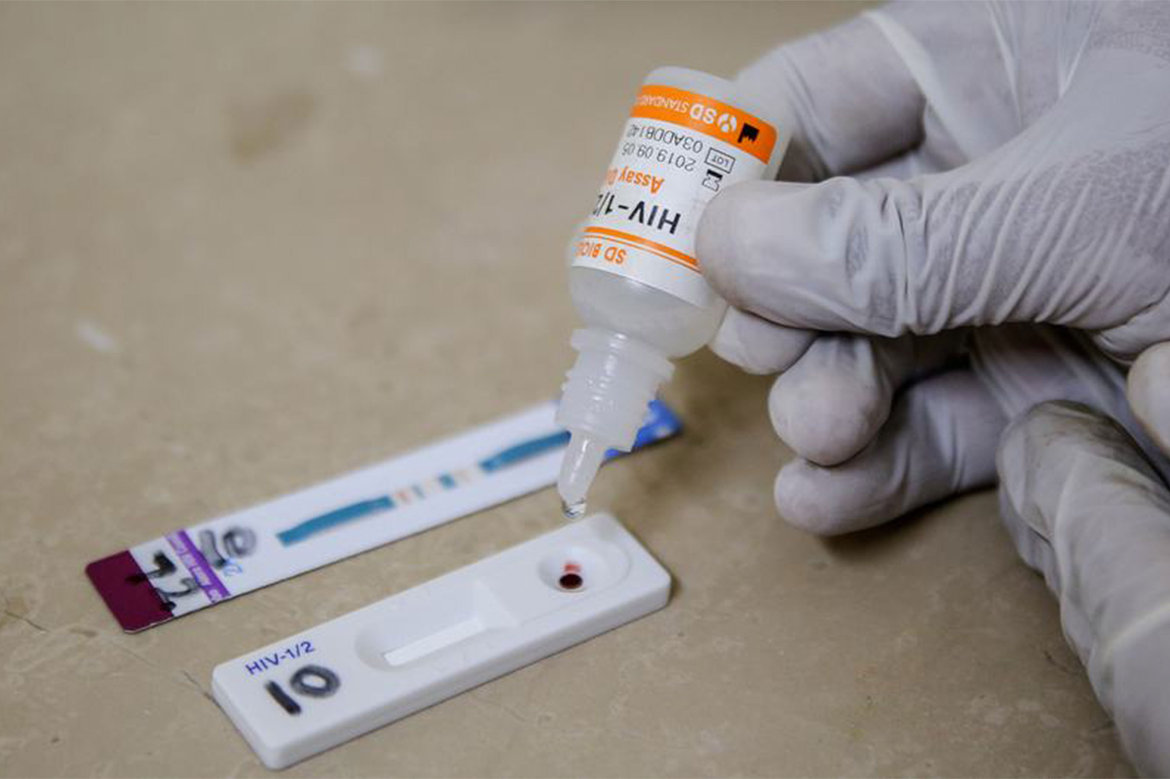 VIH : les coupes budgétaires font vaciller des années de progrès contre le sida