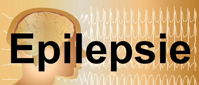 Tout savoir sur l’épilepsie