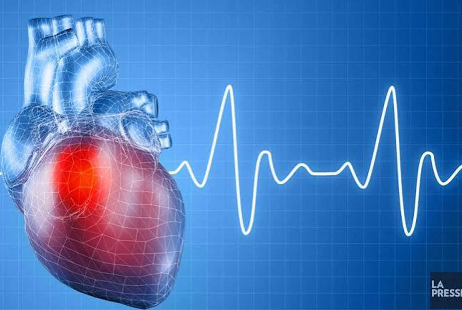 Maladies cardiovasculaires